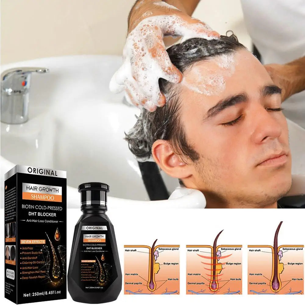 Hair Growth Shampoo, Ginger Shampoo Deep Cleaning Nourish Scalp Deep Cleaning Nourish Scalp Enhance Hair Elasticity Hair Tools