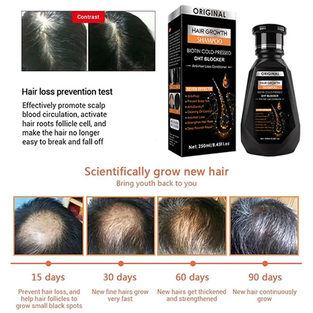 Hair Growth Shampoo, Ginger Shampoo Deep Cleaning Nourish Scalp Deep Cleaning Nourish Scalp Enhance Hair Elasticity Hair Tools