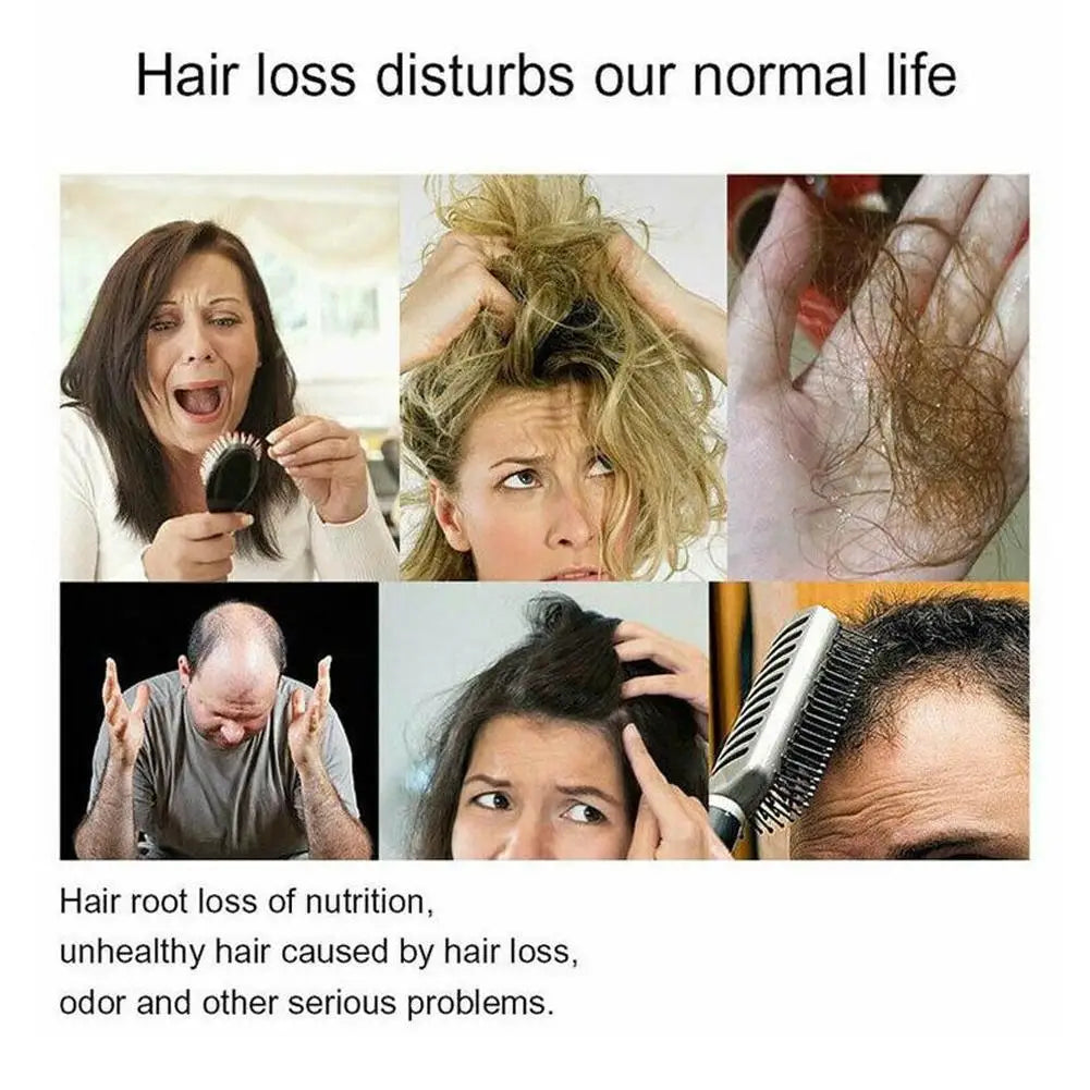 Hair Growth Shampoo, Ginger Shampoo Deep Cleaning Nourish Scalp Deep Cleaning Nourish Scalp Enhance Hair Elasticity Hair Tools