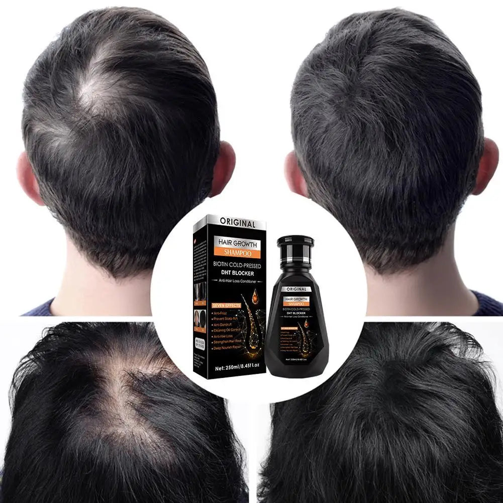 Hair Growth Shampoo, Ginger Shampoo Deep Cleaning Nourish Scalp Deep Cleaning Nourish Scalp Enhance Hair Elasticity Hair Tools