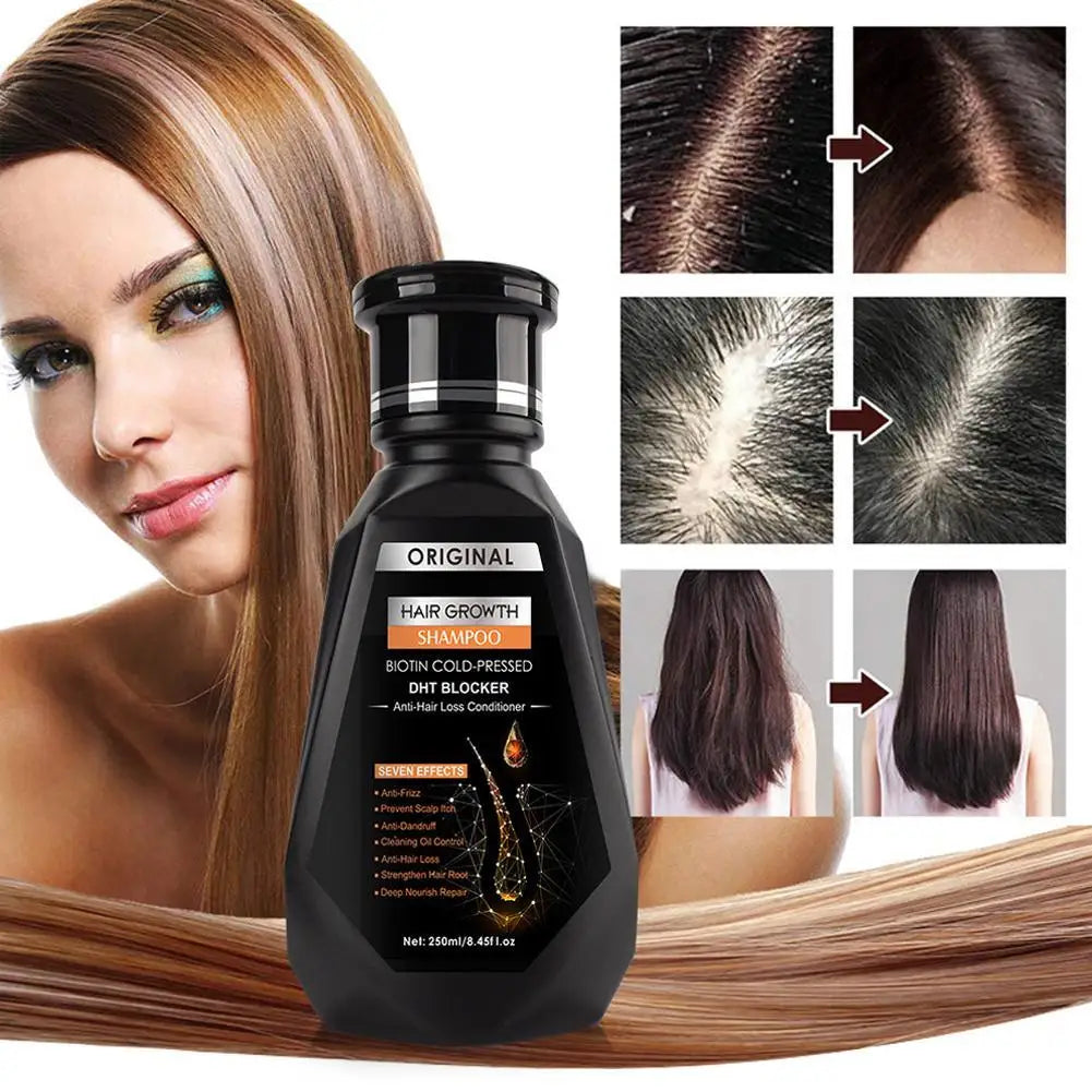 Hair Growth Shampoo, Ginger Shampoo Deep Cleaning Nourish Scalp Deep Cleaning Nourish Scalp Enhance Hair Elasticity Hair Tools